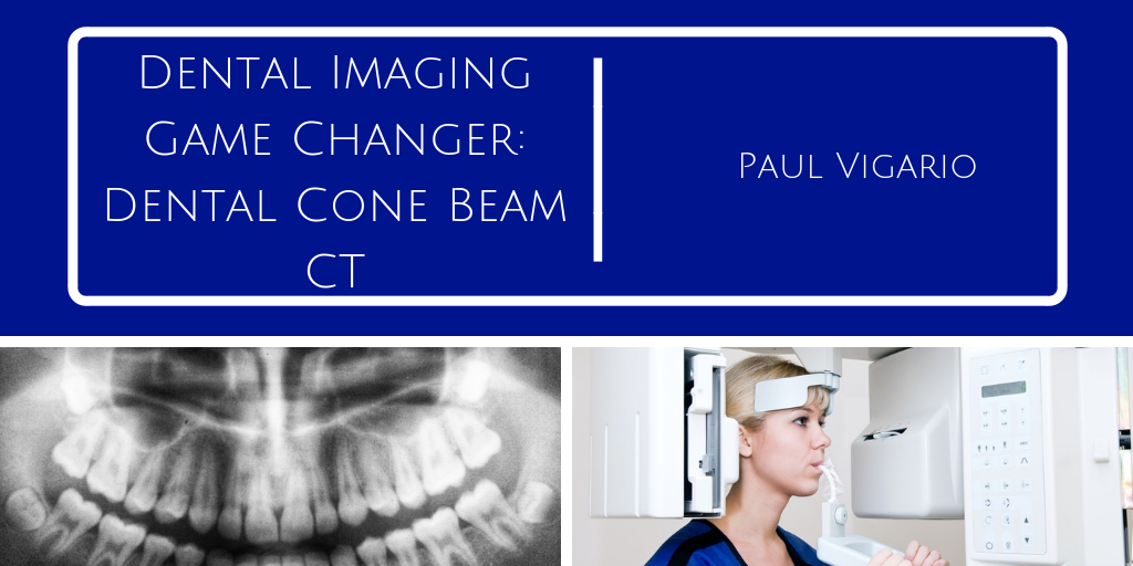 Dental Imaging Game Changer: Dental Cone Beam CT